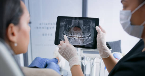 Licensed Wisdom Tooth Removal service in McLean, VA - Smile Center Dentistry